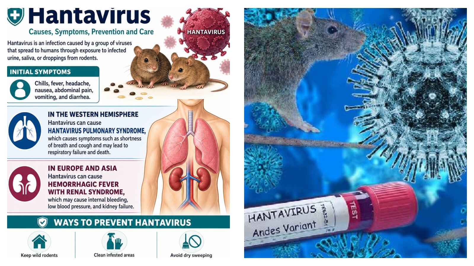 Hantavirus