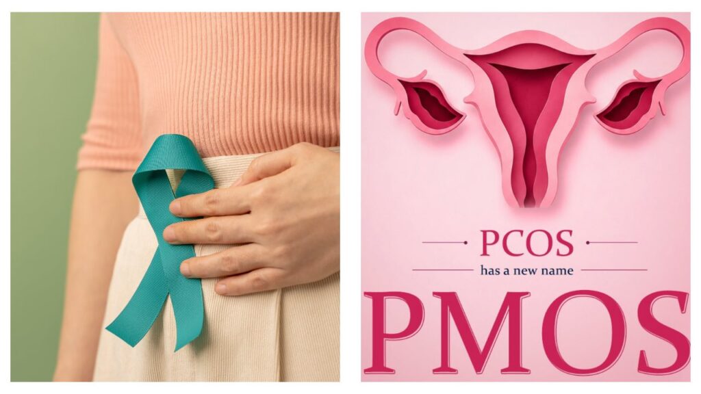 PCOS PMOS name change