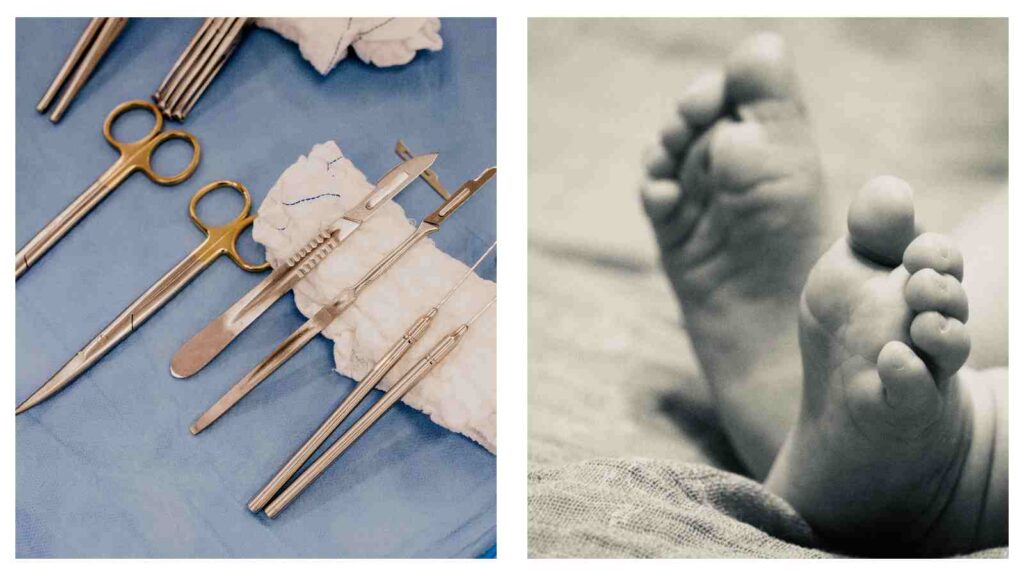 Surgical instruments and baby feet