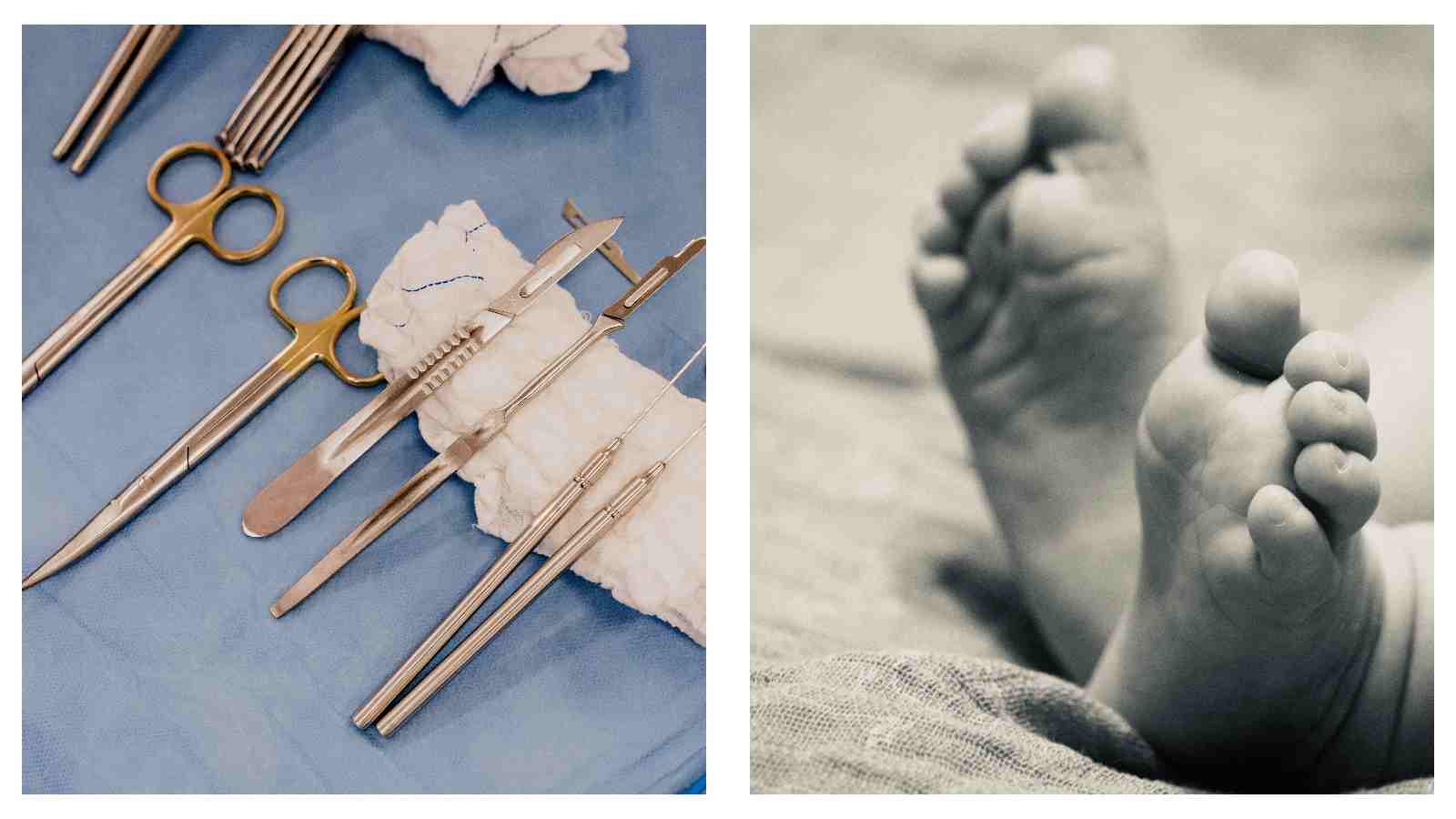 Surgical instruments and baby feet