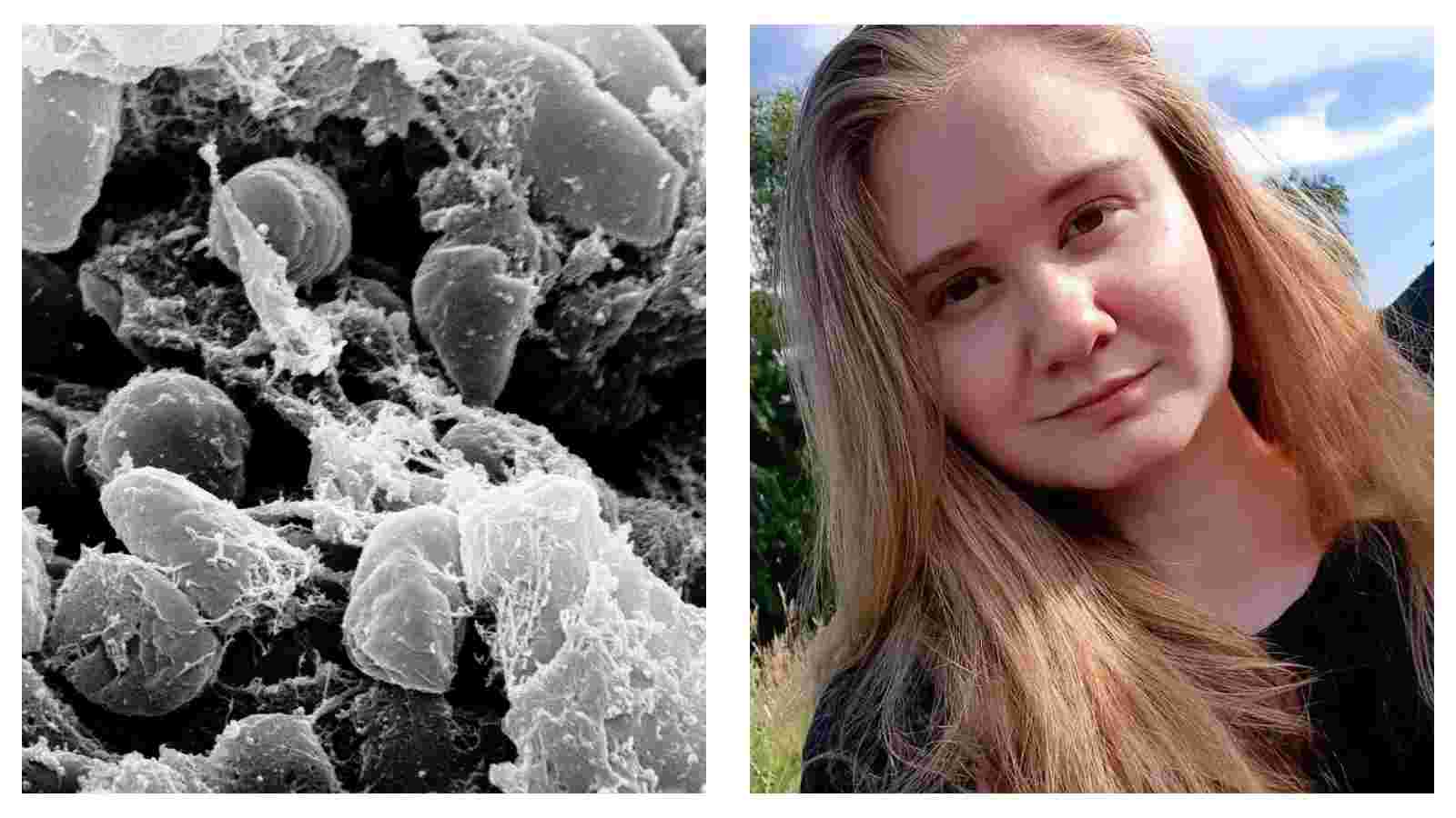 Pneumonic Plague: What we know after Russian lab worker dies of 'unknown' pneumonia